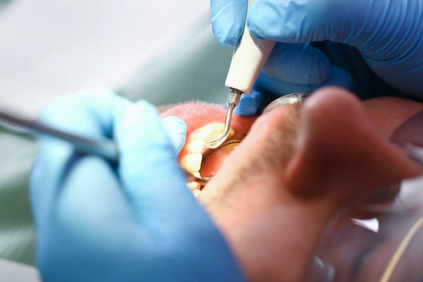 Best Emergency Treatment for Toothache in Raleigh Hills, OR